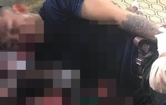 Nổ lớn ở quán cà phê, người đàn ông xăm trổ bị nát bàn tay