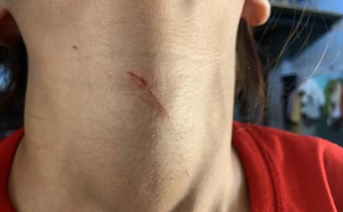 Vụ cô gái 17 tuổi bị dí dao, ép vào nhà vệ sinh rồi cướp bông tai: Danh tính nghi phạm