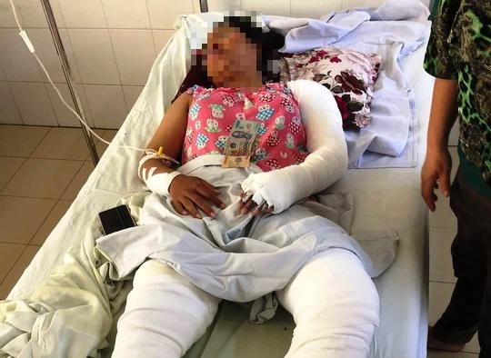 Mẹ kế tẩm xăng đốt sách vở của con chồng, khiến cả nhà bị bỏng nặng