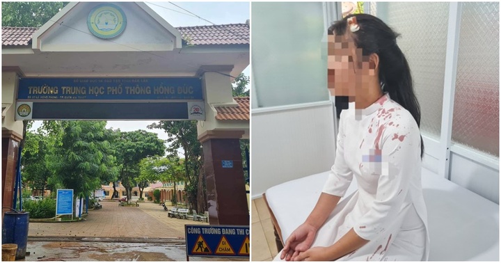Xác minh vụ nữ sinh lớp 10 bị bạn đánh chấn thương đầu trong giờ ra chơi