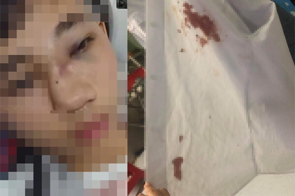 Vụ nam sinh lớp 10 ở Bình Định bị bạn đánh hội đồng: Trường THPT An Nhơn số 3 báo cáo gì?