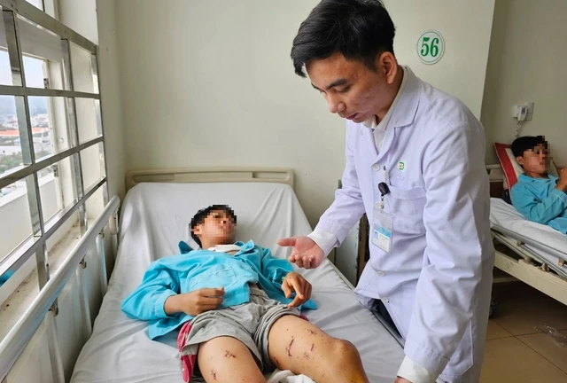 Lên mạng học chế tạo pháo nổ, nam sinh lớp 6 nhập viện cấp cứu