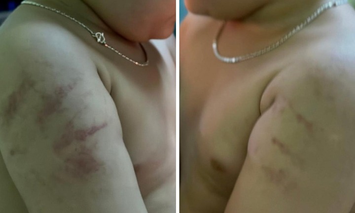 Vụ bé trai 3 tuổi nghi bị bạo hành ở Bình Định: Bất ngờ với trần tình của cô giáo mầm non