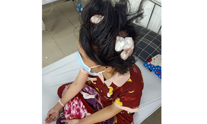 Vụ thiếu nữ 16 tuổi bị cha dượng dùng tuýp sắt đánh bất tỉnh: Diễn biến mới nhất