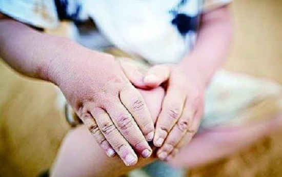 Con kêu đau chân, bố mẹ vô lo vô nghĩ, cuối cùng hại cả một đời đứa trẻ
