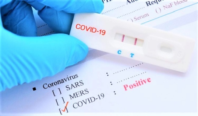 Đà Nẵng thanh tra việc mua kit xét nghiệm COVID-19