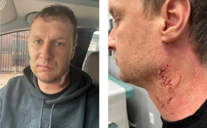 Người đàn ông Ukraine ở Mỹ đánh trọng thương đồng hương vì 