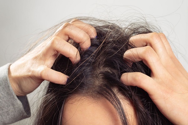 Cùng dầu gội gừng trị ngứa da đầu, tạm biệt gàu ngứa