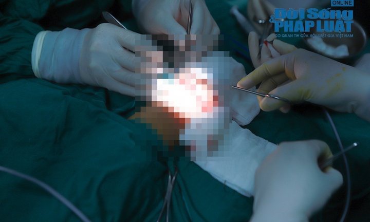 Hỏng vòng 1 do cơ địa, nữ bệnh nhân viện cớ do bác sĩ thực hiện kỹ thuật sai để đòi bồi hoàn kinh phí