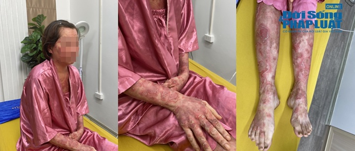 Người phụ nữ đau đớn mong mắc ung thư sau hơn 10 năm “sống chung” với căn bệnh cả đời không khỏi