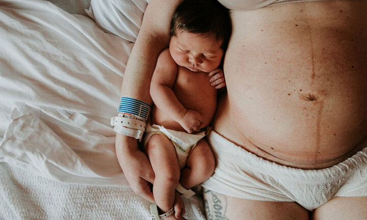 Nhiều chị em “nghiện” giảm cân sau sinh: Bác sĩ cảnh báo nguy hại