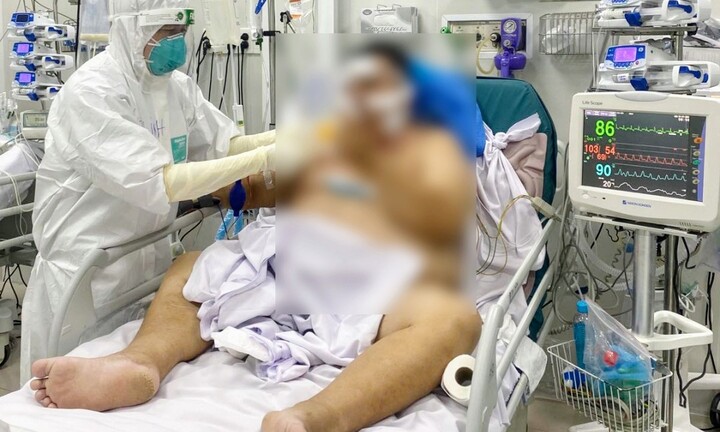 TP.HCM: Hai bệnh nhân COVID-19 tiên lượng xấu đang hồi phục