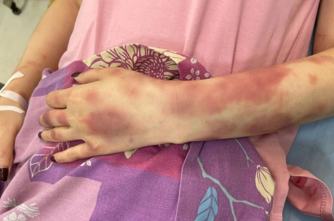 Vụ cán bộ Quản lý thị trường bị tố đánh đập, lột đồ người tình: Diễn biến mới nhất