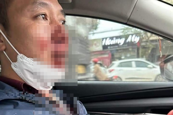 Thầy giáo dạy môn sinh học ở Hà Tĩnh bị hành hung, cướp tài sản giữa đường