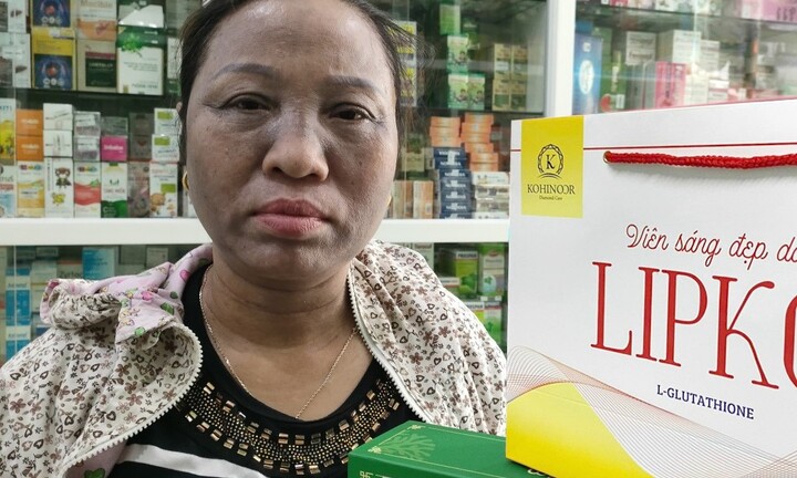 Mặt đen như nhọ nồi bôi vì dùng kem trộn