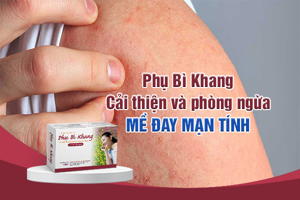 Cải thiện và phòng ngừa mề đay mạn tính nhờ Phụ Bì Khang