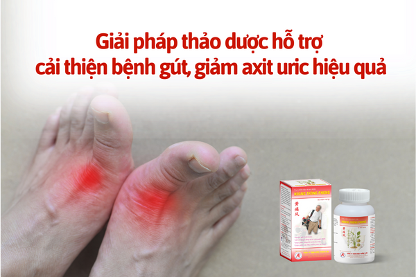 Bật mí giải pháp giảm sưng đau khớp do gút, giảm axit uric hiệu quả