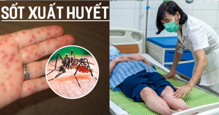 Tự mua thuốc điều trị sốt xuất huyết, người đàn ông suýt