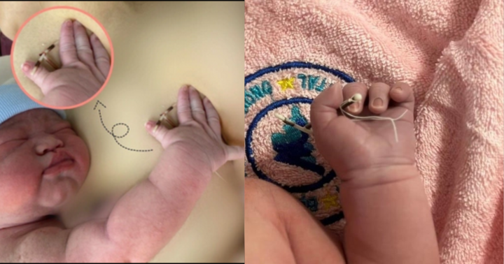 Sự thật đằng sau hình ảnh em bé chào đời cầm trên tay chiếc vòng tránh thai