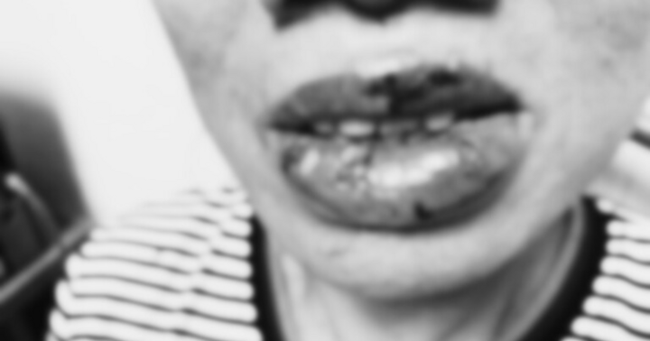 Người phụ nữ gặp biến chứng 