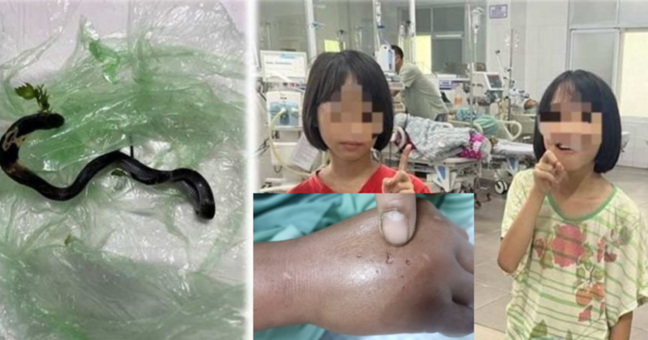 Truyền 10 lọ huyết thanh cấp cứu 2 chị em sinh đôi cùng bị rắn hổ mang tấn công