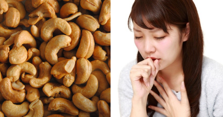 Uống thuốc ho không khỏi, đi khám phát hiện mảnh hạt điều trong phổi