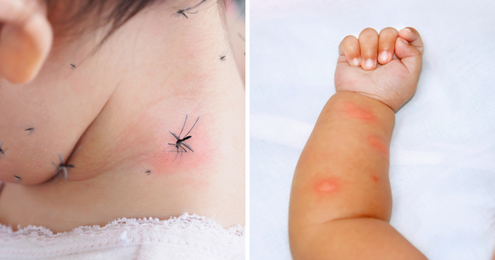 Cà Mau: Trẻ 10 tuổi tử vong vì sốt xuất huyết