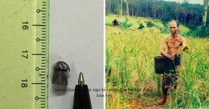 Người đàn ông bất ngờ bị trúng