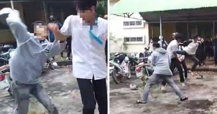 Nam sinh ở Đắk Lắk nhập viện sau khi bị bạn dùng mũ bảo hiểm đánh