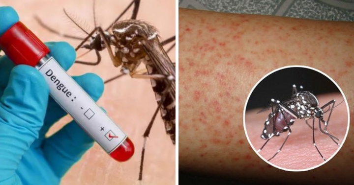Nên xét nghiệm sốt xuất huyết ở ngày thứ mấy từ khi phát bệnh?