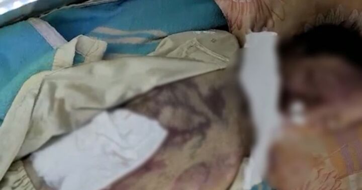 Bình Định: Phát hiện cụ bà 97 tuổi tử vong trên giường cùng nhiều vết bầm ở mặt và chân 