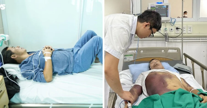 Xuất huyết tiêu hoá, chảy máu dạ dày sau 5 ngày sốt cao vì sốt xuất huyết
