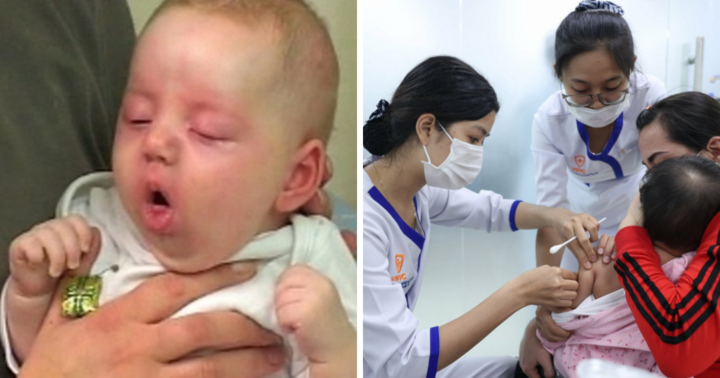 Xuất hiện ca ho gà đầu tiên ở Hà Nội là bé gái 6 tuần tuổi