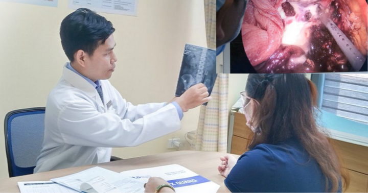 Bị sỏi thận 8 năm, đến viện phát hiện thận nhiễm khuẩn, ứ đầy mủ trắng như