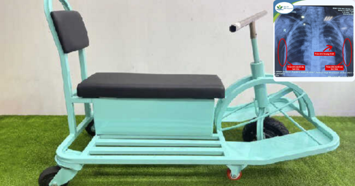 Ngã khi chơi xe 3 bánh, bé trai 6 tuổi nguy kịch tính mạng