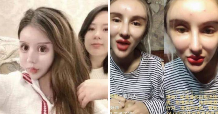 Nghiện làm đẹp đến mức chi 14 tỷ đồng cho 200 cuộc 