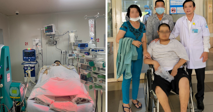 Cứu sống nam thanh niên 21 tuổi bị sốt xuất huyết nặng, suy đa cơ quan