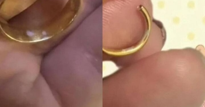 Nhẫn vàng đổi màu, cô gái bỗng phát hiện mối nguy hiểm chết người từ thứ 