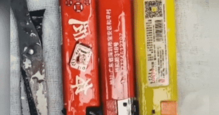 Hy hữu: Người đàn ông nuốt cả cây kéo và 3 cái bật lửa vì...say rượu