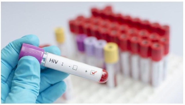 Phát hiện người phụ nữ tự khỏi HIV, không cần dùng thuốc