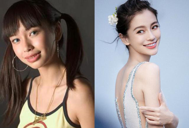 Sử dụng trái phép hình ảnh thời chưa chỉnh răng của Angela Baby, một bệnh viện nha khoa bị kiện