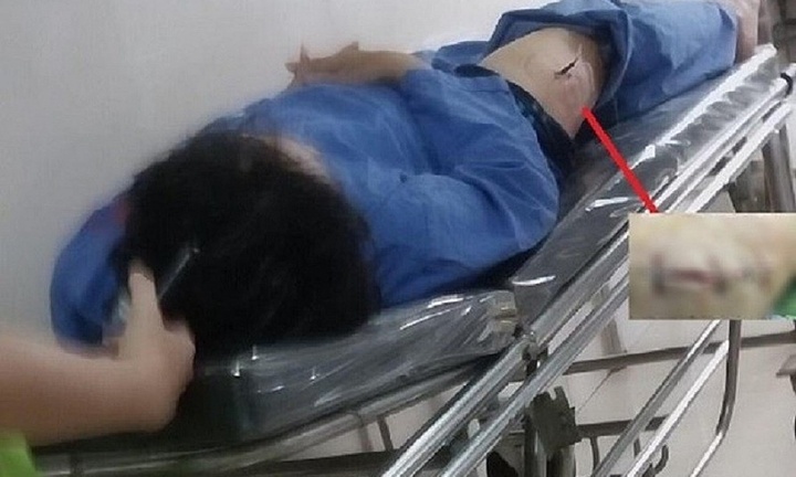 Lời khai của đối tượng đâm cán bộ thuế Ninh Bình