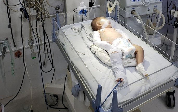 Điều tra vụ bé 3 tháng tuổi cấp cứu trong tình trạng đa chấn thương, nghi bị bạo hành