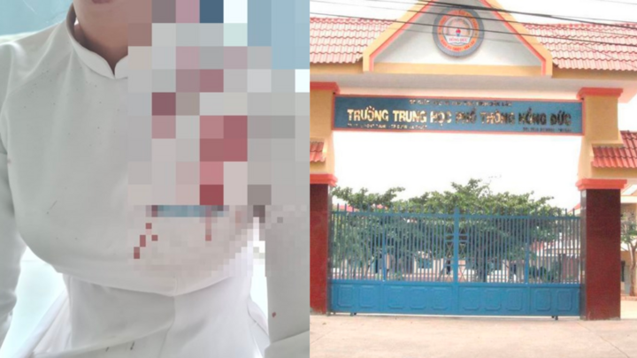 Mẹ nữ sinh bị bạn đánh chấn thương đầu: 