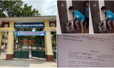 Nam sinh lớp 7 tổn thương tâm lý vì bị bạn đánh đi học trở lại