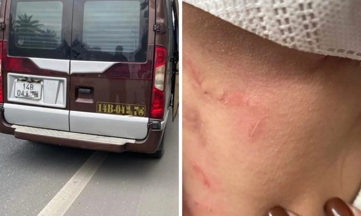 Vụ nhà xe bị tố hành hung, bỏ rơi khách giữa cao tốc: Tài xế khai gì?