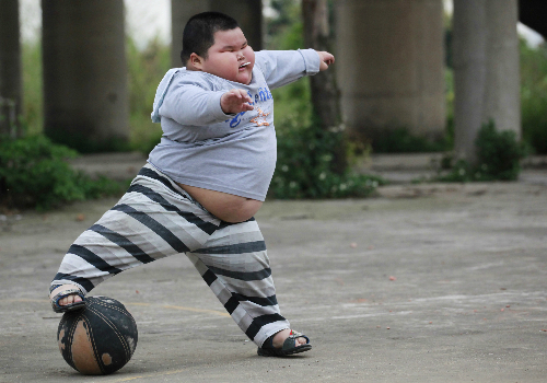 Béo phì ở trẻ em: Nhiều hậu quả về thể chất lẫn tâm lý