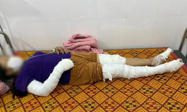 Nghệ An: Dựng cây nêu vướng đường dây cao thế, 3 người bị điện giật 