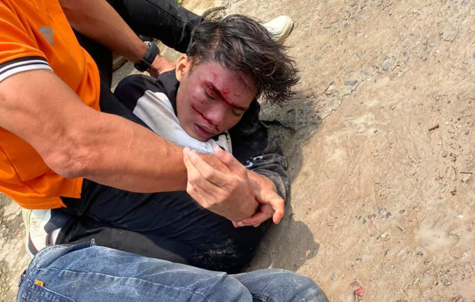 Đặt mua chiếc nhẫn gần 100 triệu, rồi đâm nhân viên giao hàng để cướp