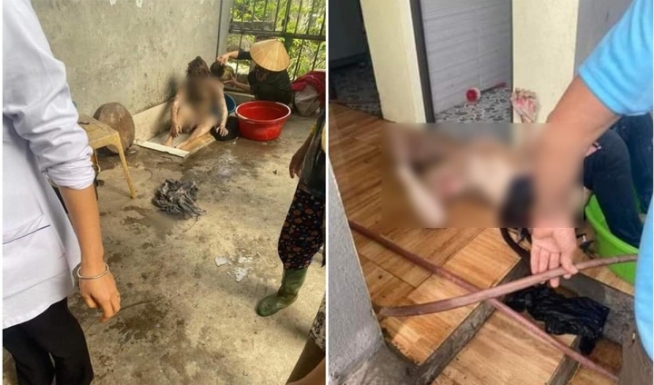 Hải Dương: Nghi án chồng tưới xăng đốt phòng ngủ khiến 3 người bị thương